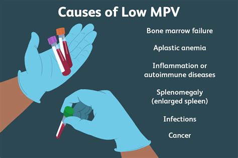 dropping mpv blood test|thrombocytopenia and mpv levels.